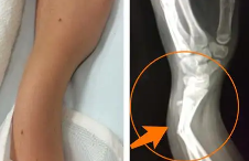 �й����˲�